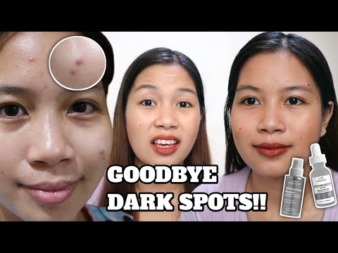 SKINCARE SET NA SOBRANG EFFECTIVE!! & ANSWERING QUESTIONS ABOUT COVID!!!